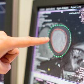 Imaging cardiovascolare