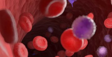 Radiation accident: Fundamentals and Medical Management
(The Swiss Treatment Concept)