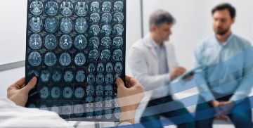 Ictus cerebrale: limitarne i danni oggi si può