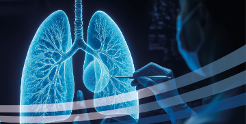 30 SETT - Lo screening salva la vita, i risultati del progetto pilota all’EOC dedicato allo screening del polmone