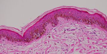 Il melanocita: non solo nei