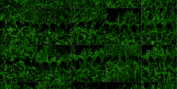 Il Laboratorio di Medicina Rigenerativa EOC sviluppa modelli 3D organo-specifici partendo da cellule derivate da pazienti