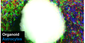 Progetto di ricerca condotto da due collaboratori dei Laboratori di Ricerca Traslazionale EOC