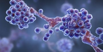 Una biopsia di pelle di soli 3mm di diametro, apre nuove prospettive per la diagnosi e la cura dell’amiloidosi