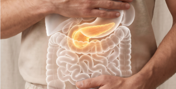 IOSI in prima linea contro il tumore del pancreas