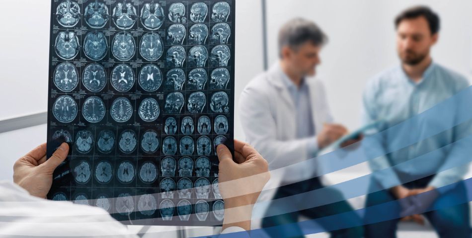 Ictus cerebrale: limitarne i danni oggi si può