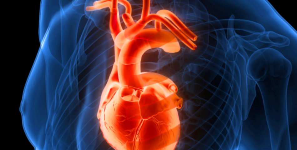 Simposio dissezione aortica. Si può prevenire?